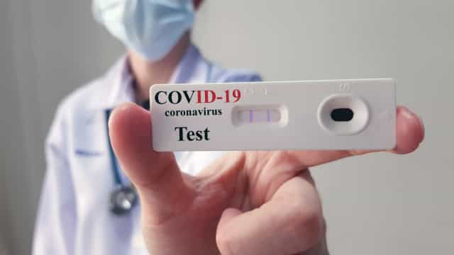 Cidade do Rio de Janeiro recebe 10 mil testes para covid-19